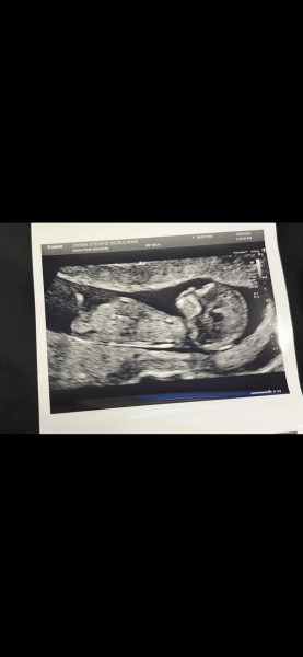 Pregnant after miscarriage - support thread NEW