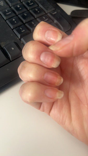 My nails are awful, is there anything that can help?