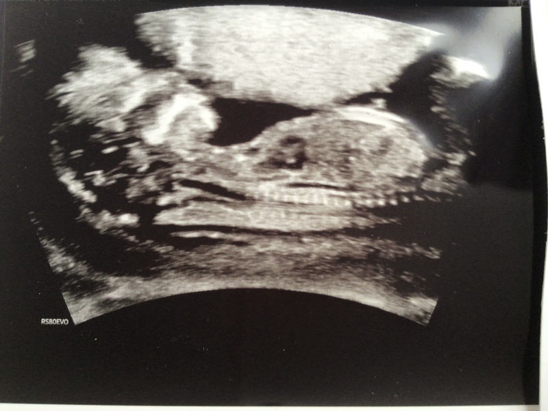 February 2024 Babies 👶 (thread 3)