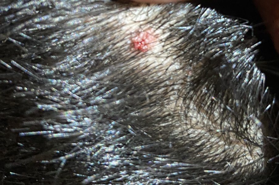 Freaking out! What’s this on DDs scalp ??!