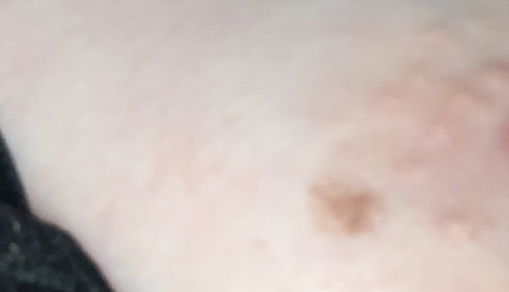 Moles