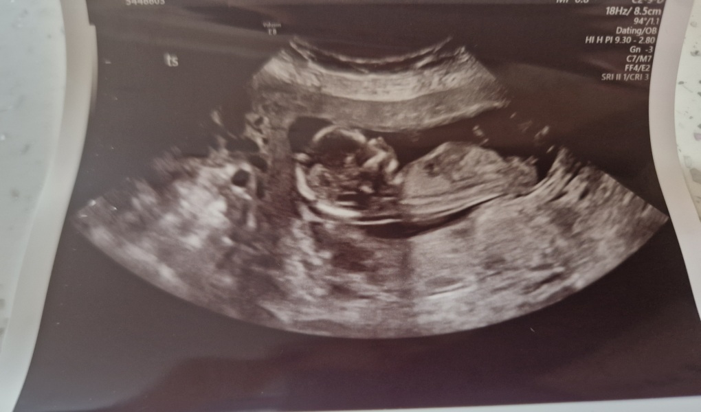 February 2024 Babies 👶 (thread 3)