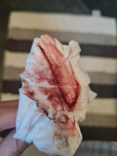 Am I having a miscarriage?