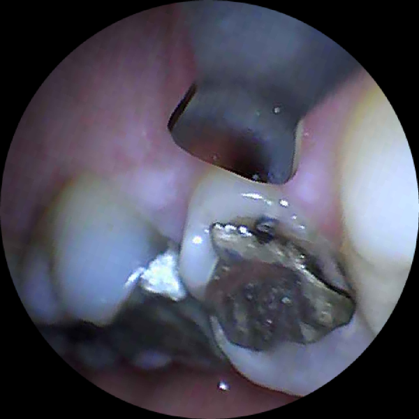 Any Dentists willing to have a look ..WARNING PICS