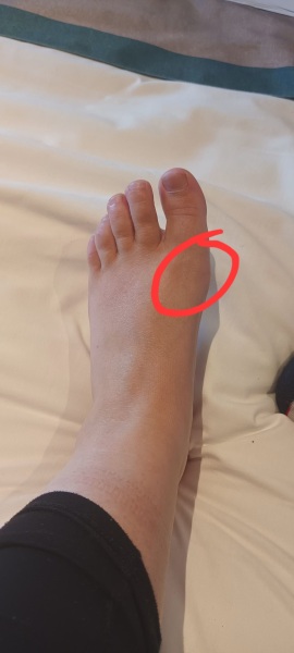 Have I broken my foot...?
