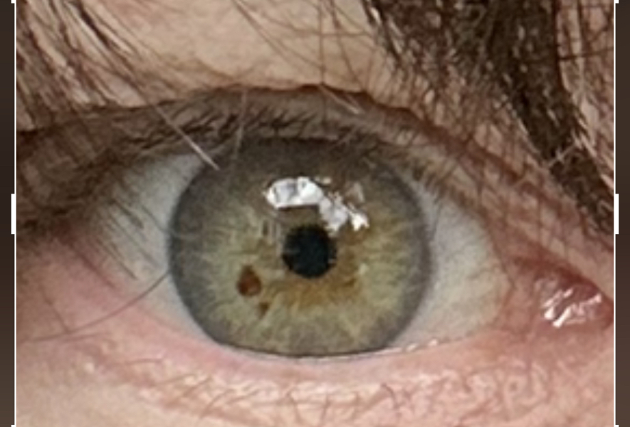 What colour are your eyes?