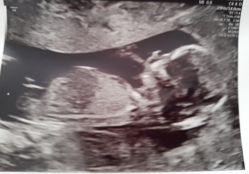 Boy or Girl