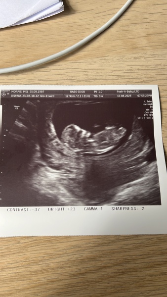 12 week scan. Any guesses?