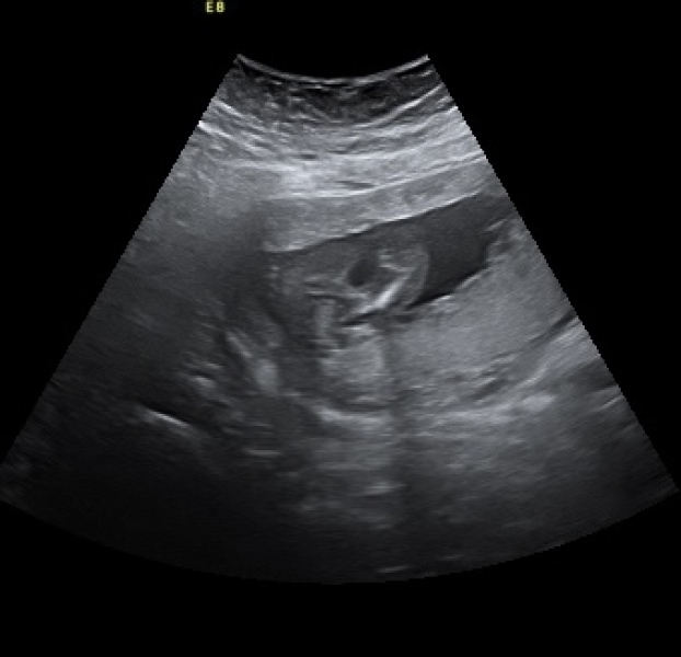 16+4 gender scan possibly wrong?