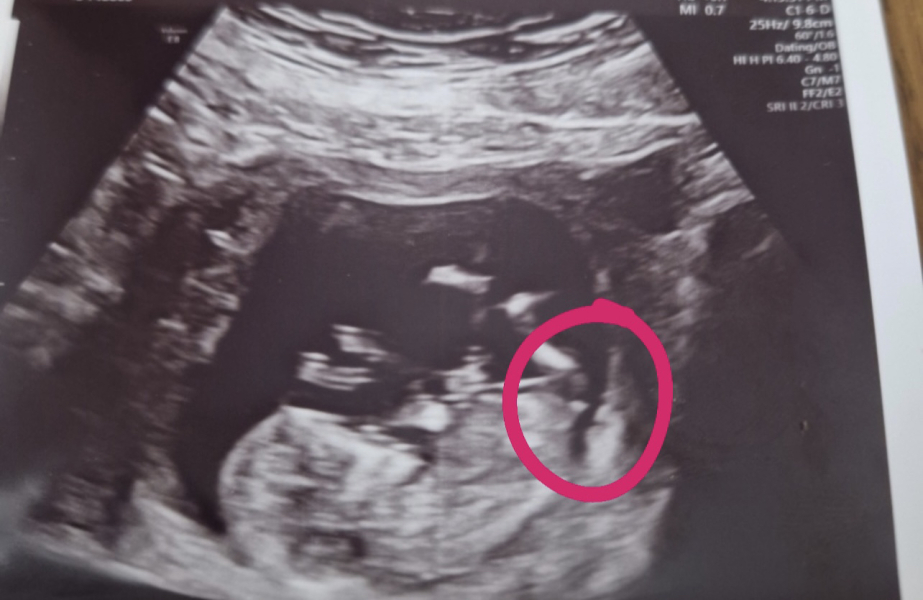 February 2024 Babies 👶 (thread 3)
