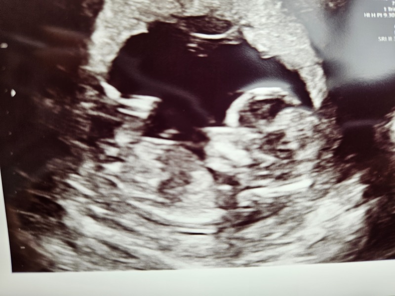 February 2024 Babies 👶 (thread 3)