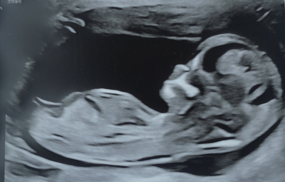 February 2024 Babies 👶 (thread 3)