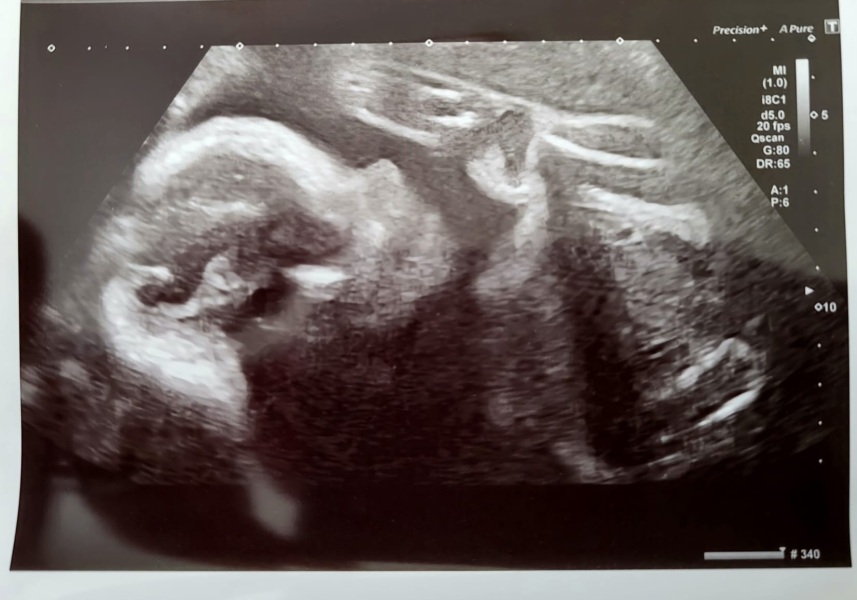 TWW - Testing Around 1st March 