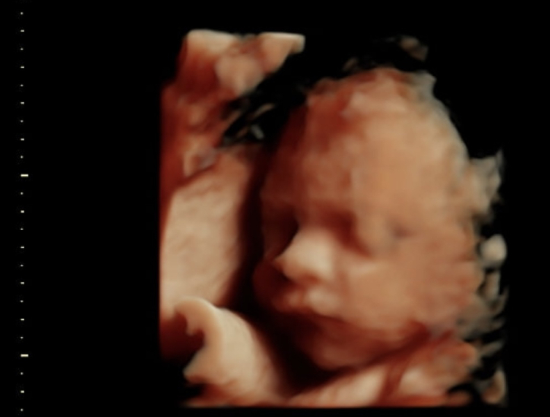 Due October 2023 Thread 8