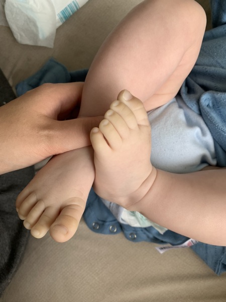 Baby's feet turn white after sitting in highchair?