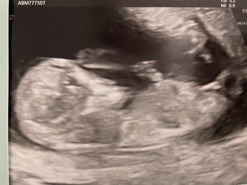 Place your random bets... nub/skull theory! 👶