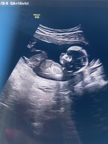 February 2024 Babies 👶 (thread 3)