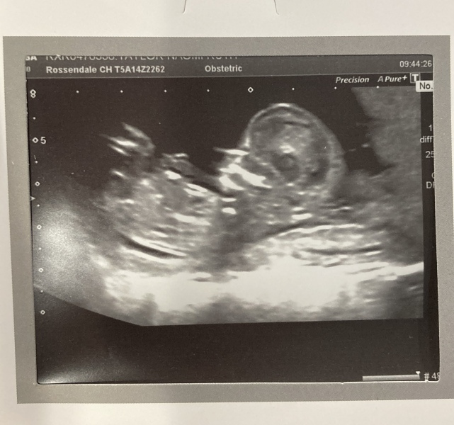 February 2024 Babies 👶 (thread 3)