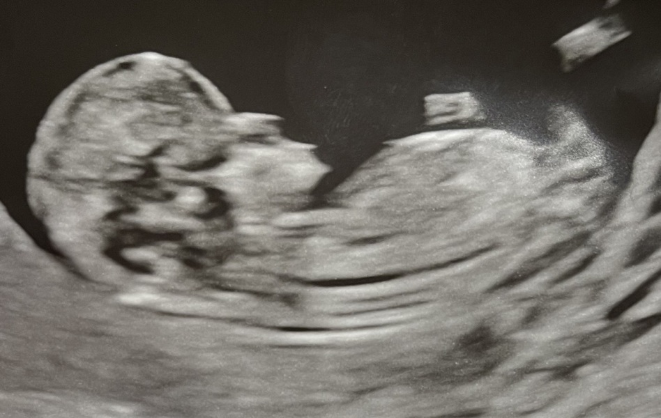 Just for fun ... boy or girl ?