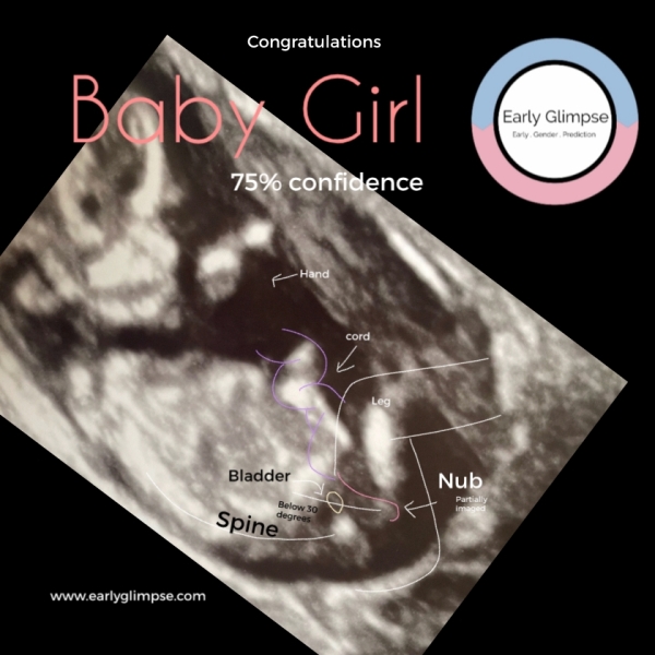 February 2024 Babies 👶 (thread 3)