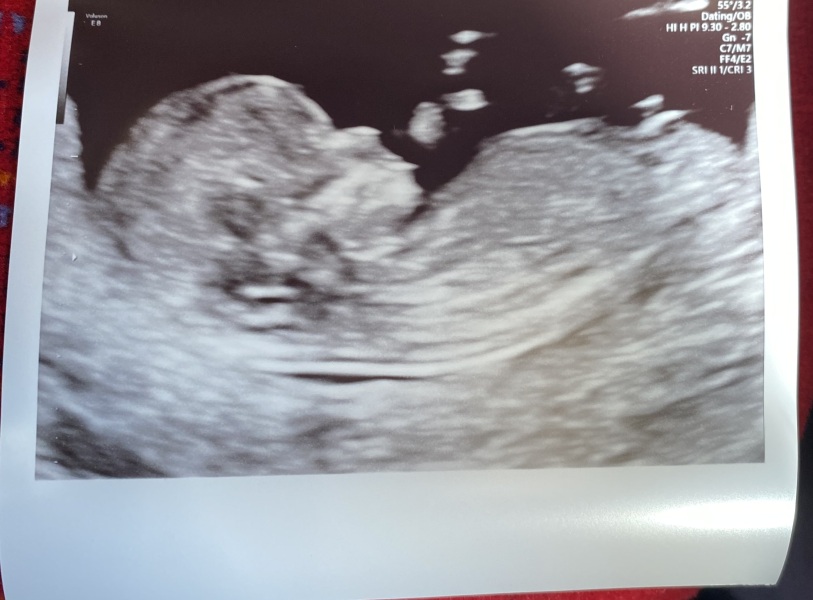 March 2024 continued!