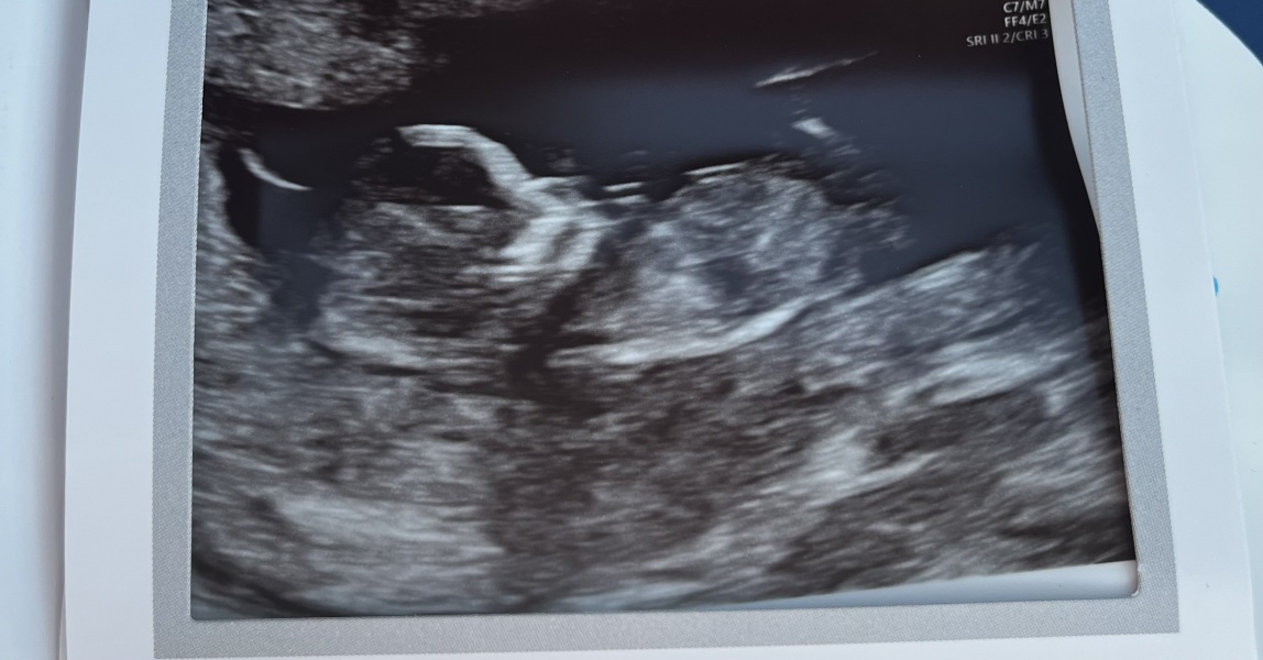 Boy or girl predictions please!