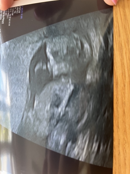 February 2024 Babies 👶 (thread 3)