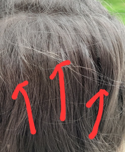 Is this headlice?  Photo attached