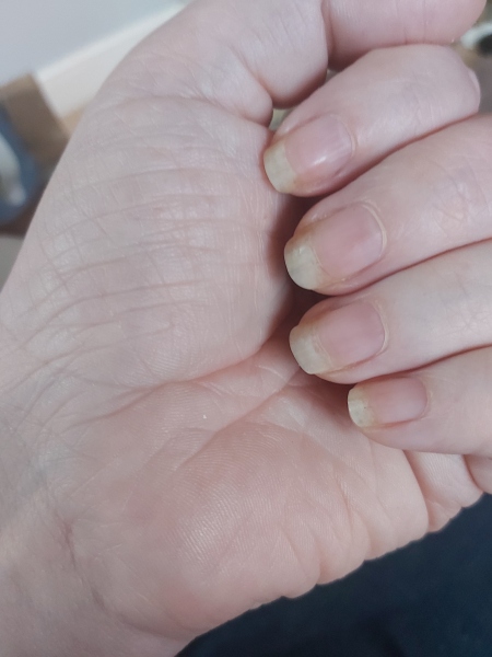 To be so fucking fed up about this *trigger warning- photo*