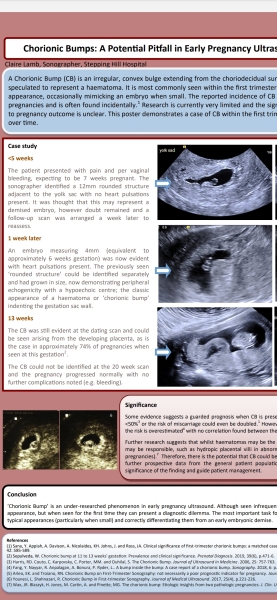 6 week scan, not good news...