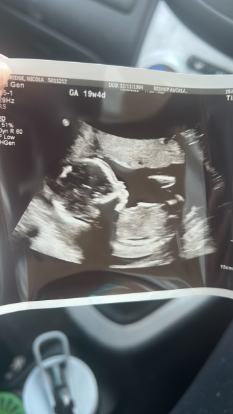 Due January Part 5 🎉