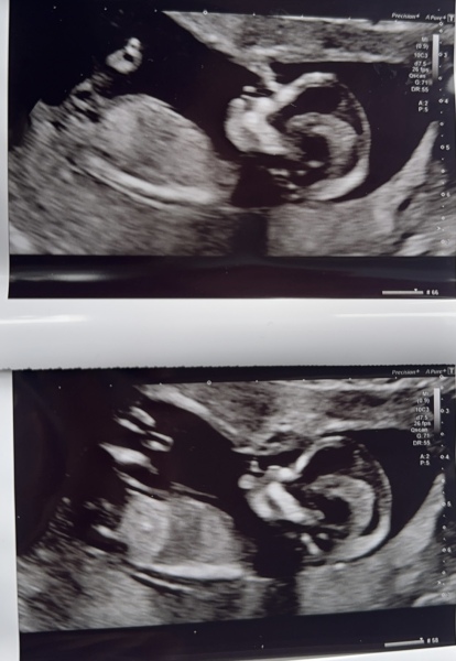 Gender nub guesses pretty please x