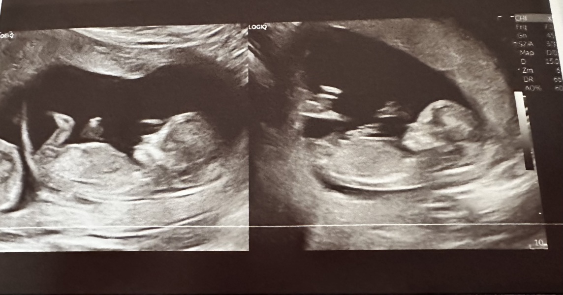 February 2024 Babies 👶 (thread 3)