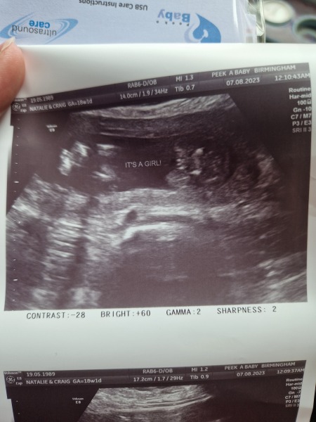 Due January Part 5 🎉