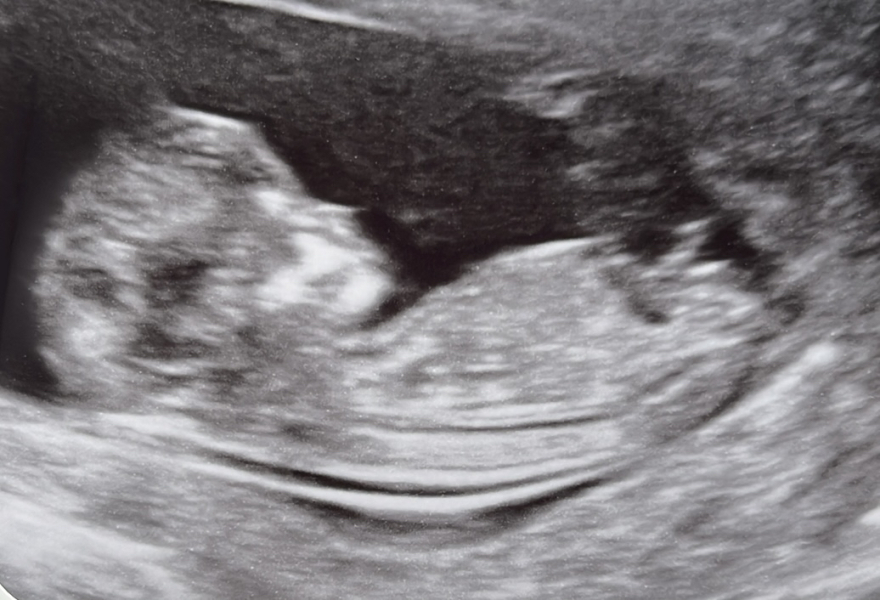 February 2024 Babies 👶 (thread 3)