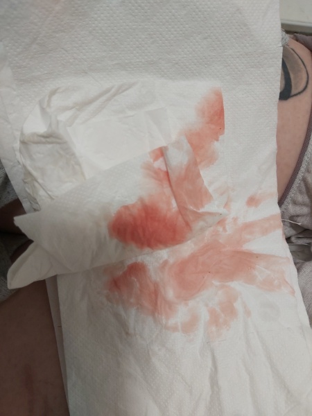 Implantation bleeding?