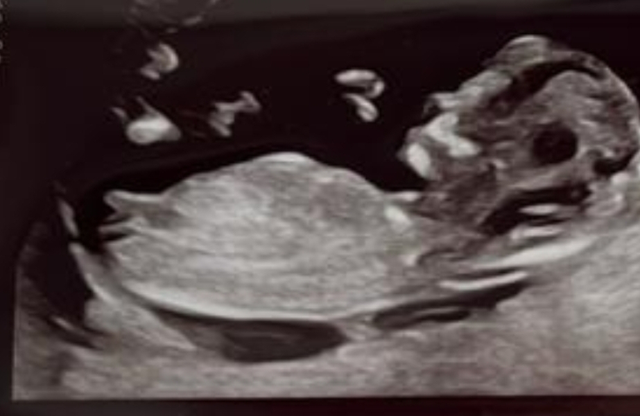 Nub prediction please- I know what I think!