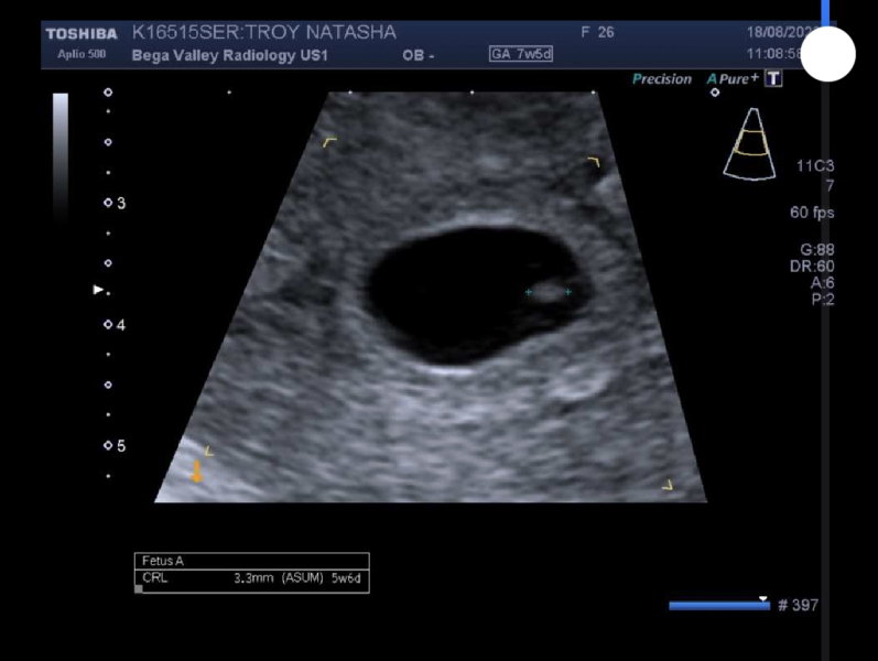 4 weeks pregnant / due April 2024