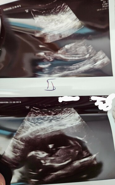 Boy or girls scan. (Bit of fun)