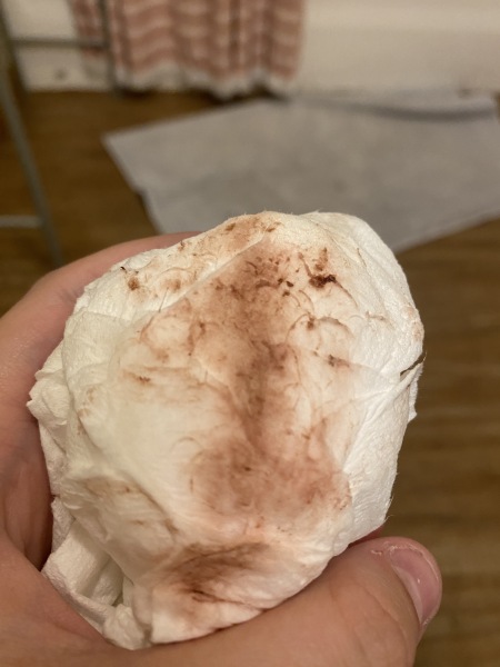 Implantation bleeding? Help!