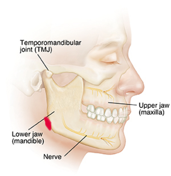 Sore jaw at corner when pressed? Diagram