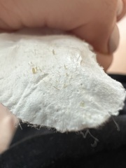Nose pore strip pics