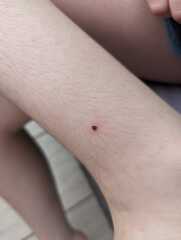 What is this on DD's leg and how urgently does it need looked at?