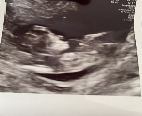 February 2024 Babies 👶 (thread 3)