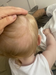 Ringworm or…not?