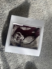 Any gender guesses from my 12 week scan?