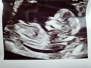 February 2024 Babies 👶 (thread 3)