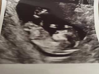 February 2024 Babies 👶 (thread 3)