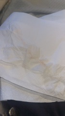Clear discharge with pink in when I wipe