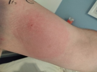 What bit DP? (Pics)